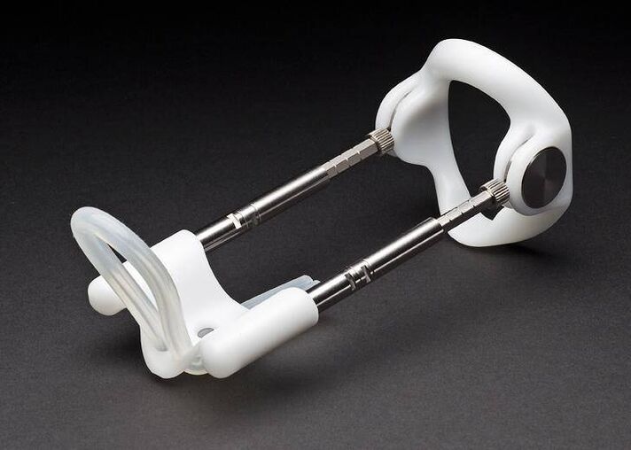 Strecker nach einer Penisvergrößerungsoperation